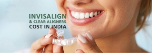 Clear Aligners in India